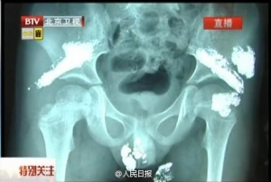 ͼ�ģ�����5����ͯ���ھ��ִ���ˮ��